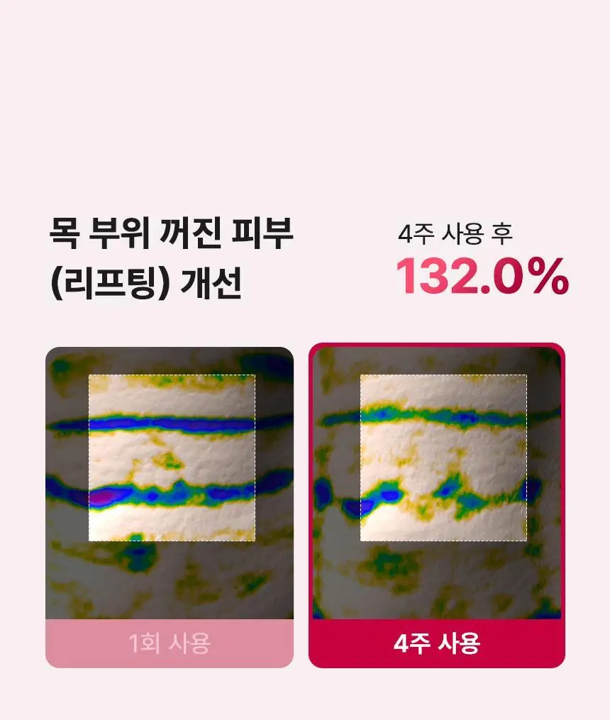 [줄기세포 넥패치/목주름] 뷰앤디 넥실키 마스크 (1매입/5매입) 상세페이지 27